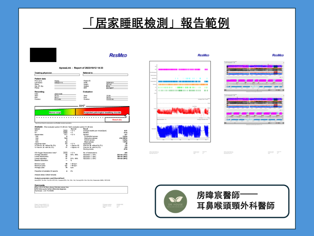 睡眠檢測報告範例