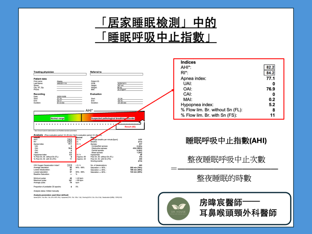 睡眠呼吸中止指數