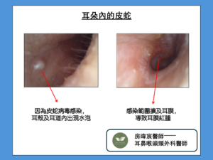 耳朵長皮蛇